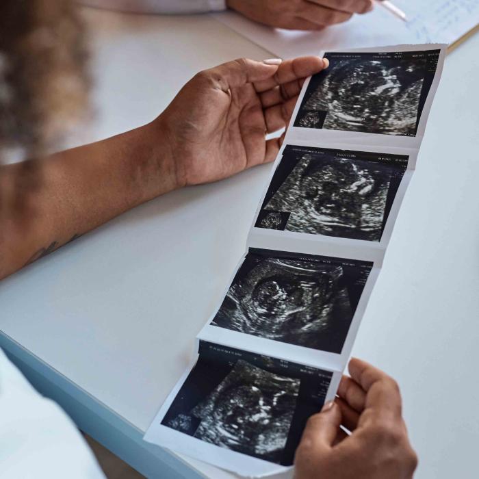 woman looking at sonogram
