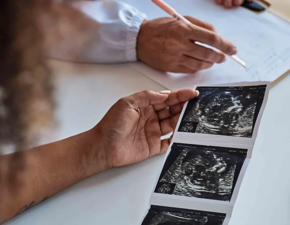 woman looking at sonogram