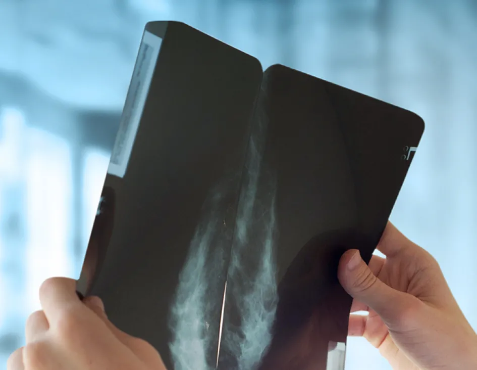 Doctor reviewing breast cancer scan